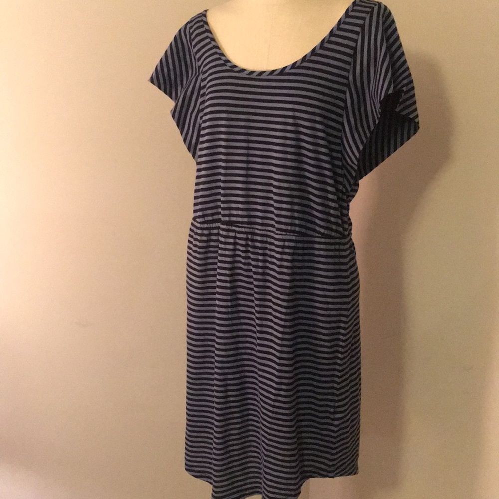 Striped casual dress with elastic waist